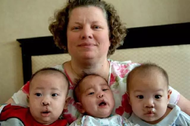 Image result for ç¾Žåœ‹äooæ”¶å…»ä¸-å›½æ®‹ç–¾å„¿ç«